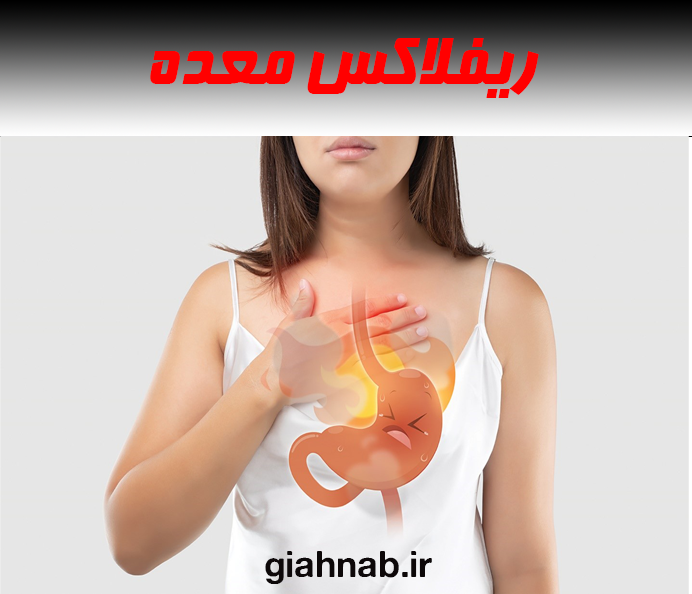 ریفلاکس معده
