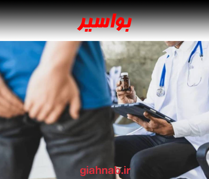 بواسیر