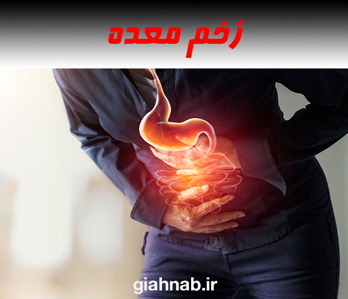 زخم معده