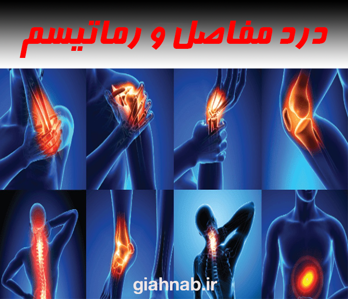 دردهای مفصلی و روماتیسم