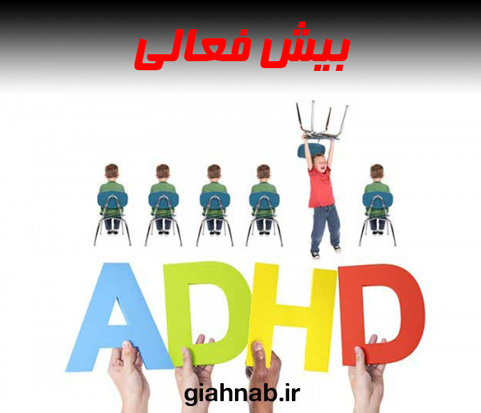 بیش فعالی