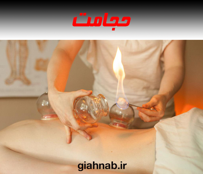 حجامت