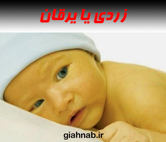 زردی