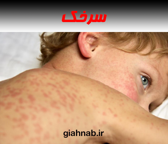 سرخک