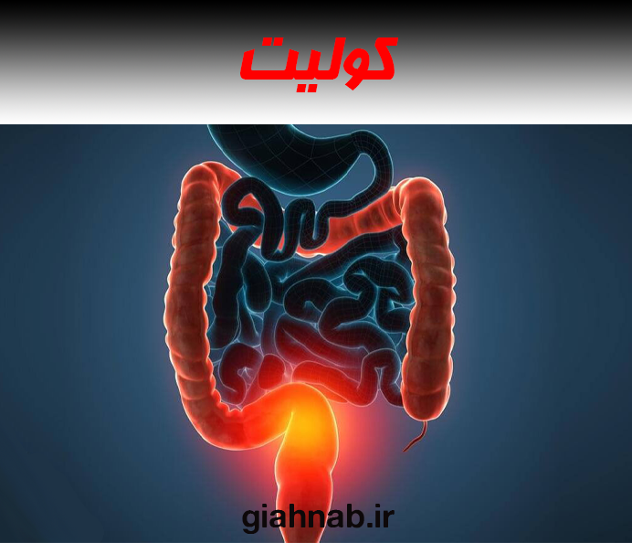 کولیت