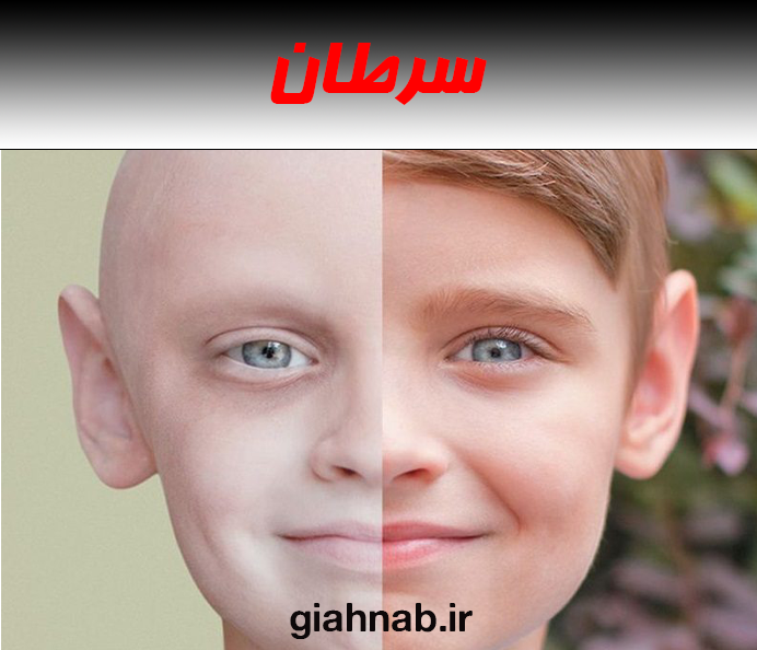 سرطان
